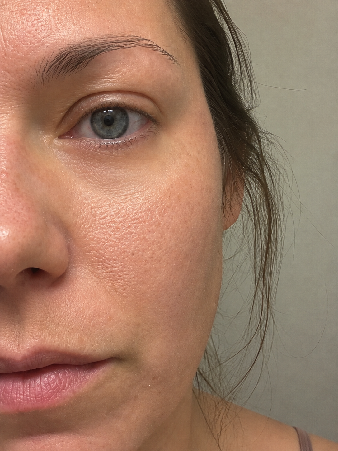 3 weeks — MIRAE