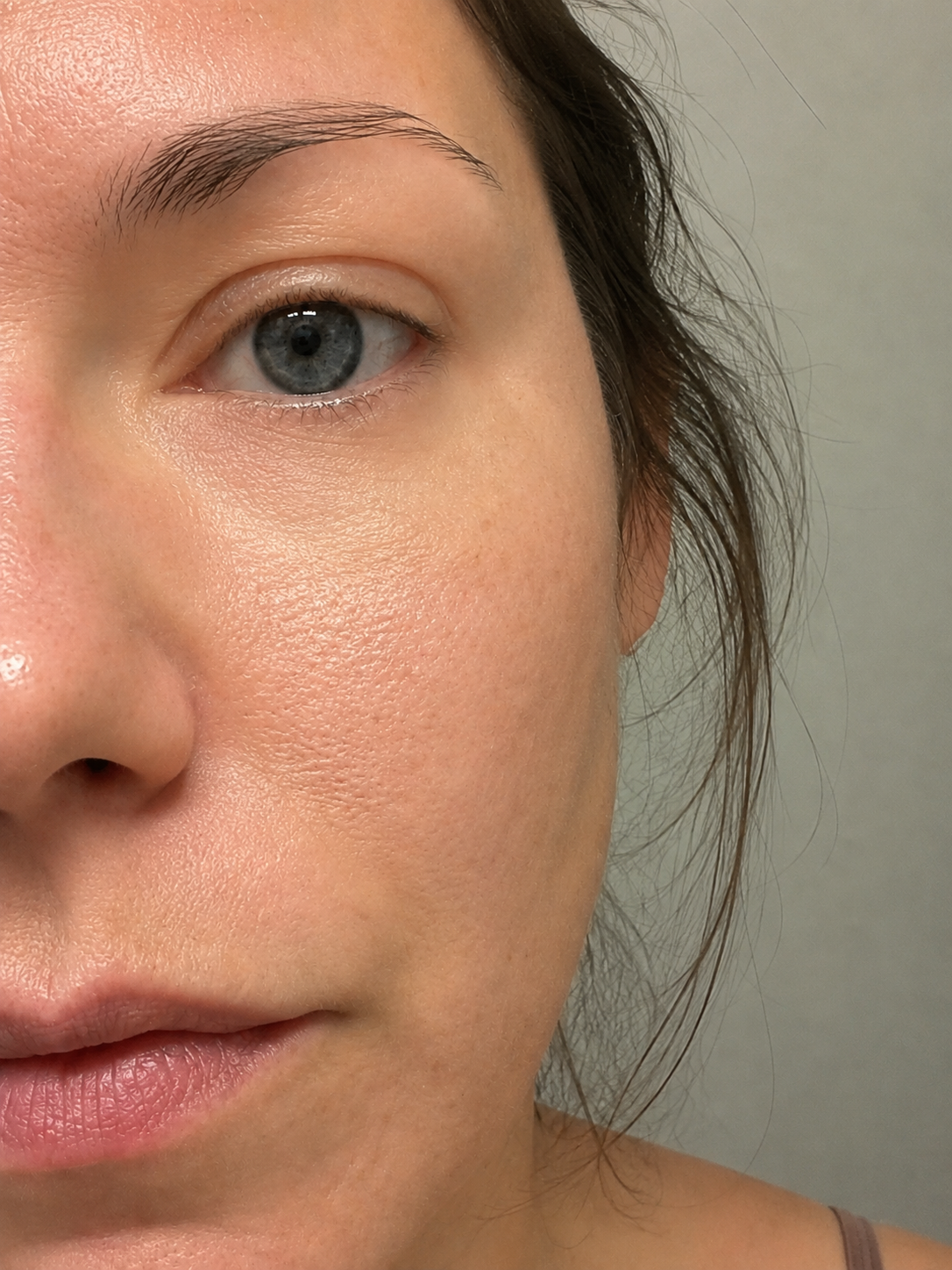 6 weeks — MIRAE